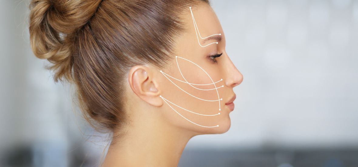 PDO Thread Lift Hackensack MedSpa